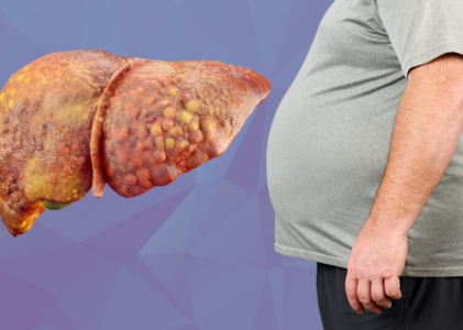 What Is Fatty Liver Disease? Symptoms, Stages and Treatment
