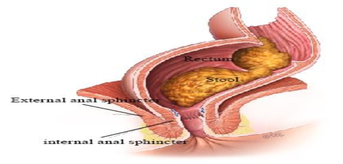 009 Figure1 1