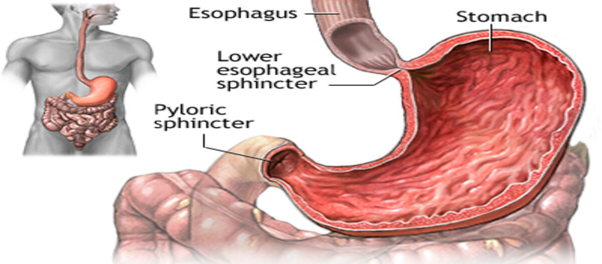 19223 1 1 e1715674006952