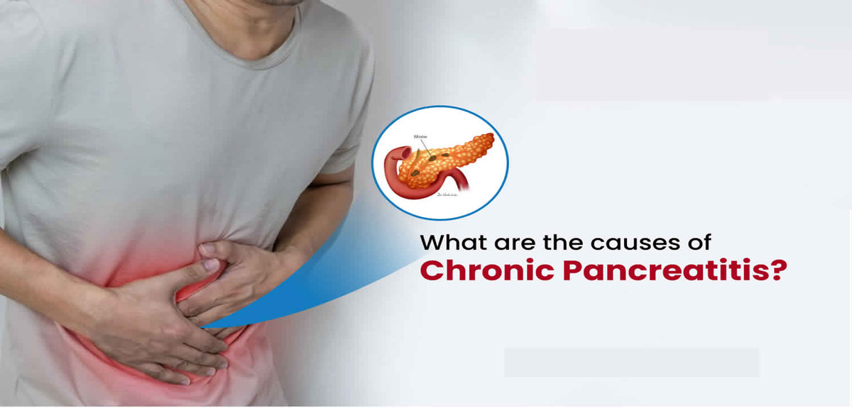 Chronic pancreatitis 1