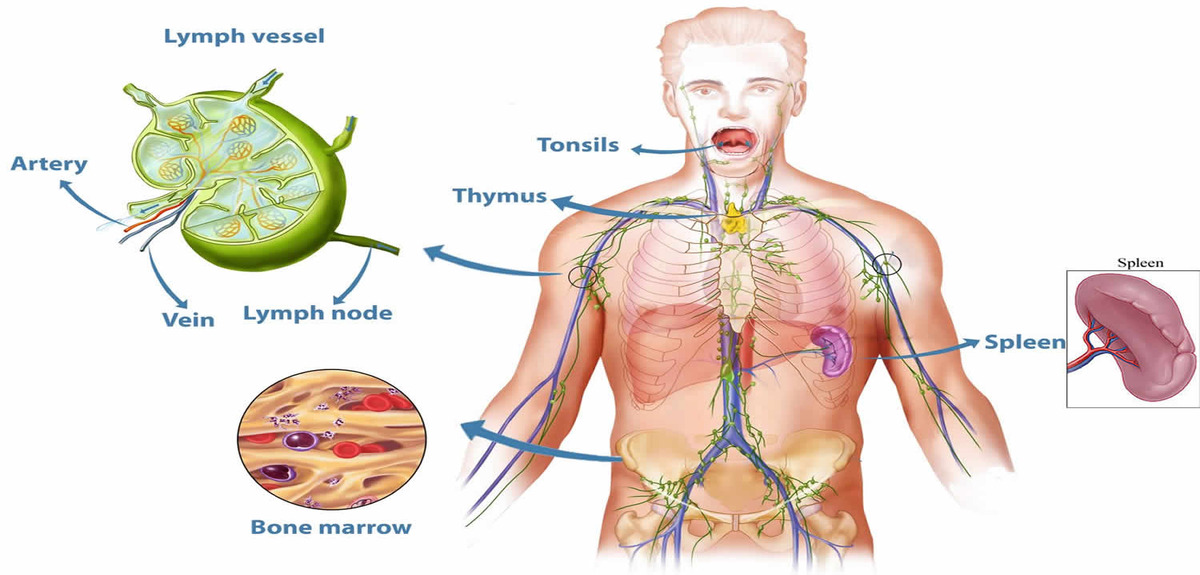 Splenomegaly 1