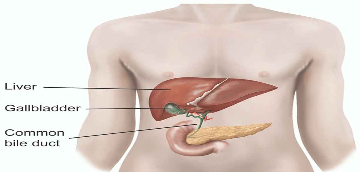 cholecystectomy and exploration of the bile duct e15e57 1