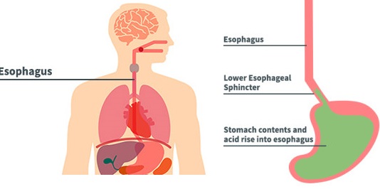 Esophagus