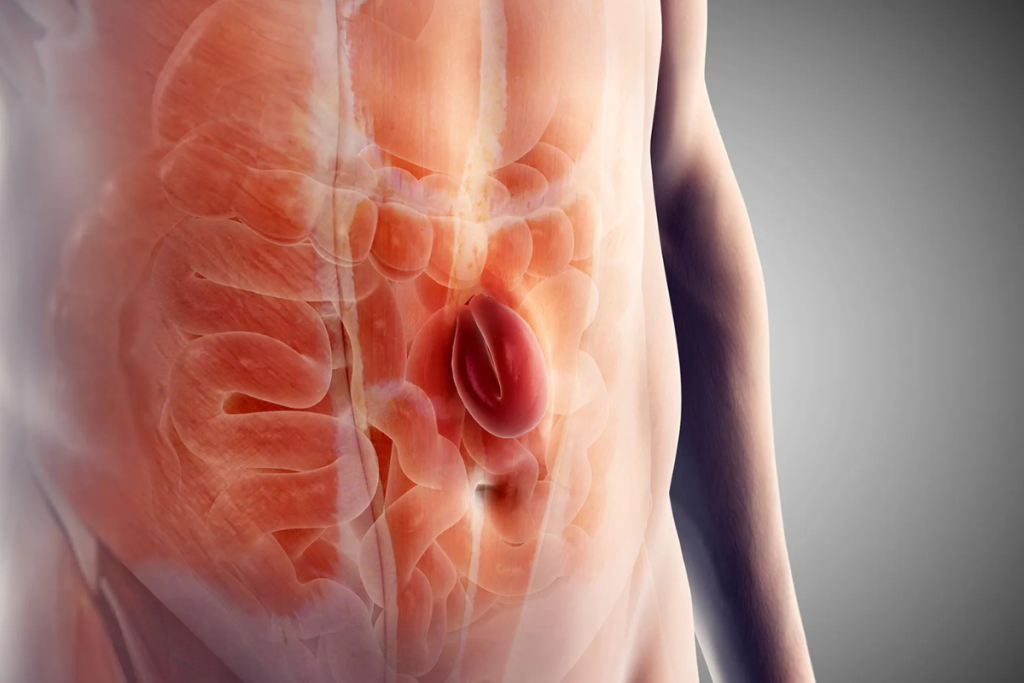 Inguinal vs. Hiatus Hernia: What’s the Difference?11