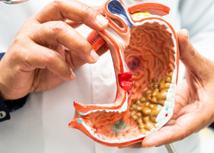 How Long Does It Take to Recover from Gastrointestinal Surgery?
