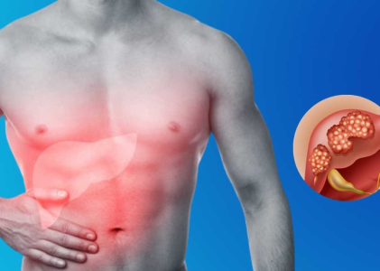 Understanding Liver Tumors: Not All Are Cancer