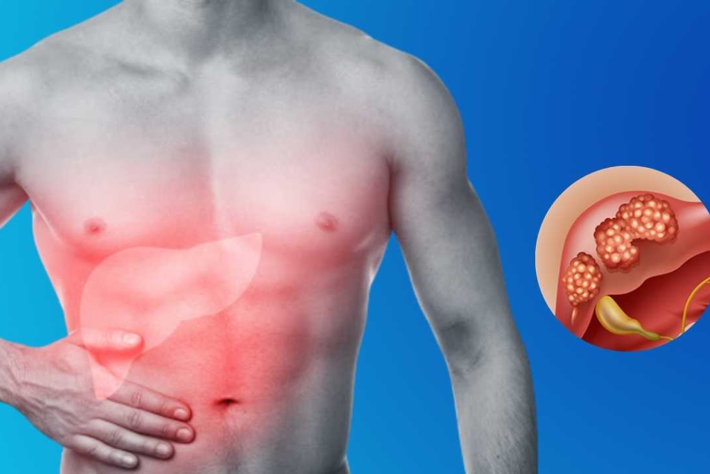 Understanding Liver Tumors: Not All Are Cancer