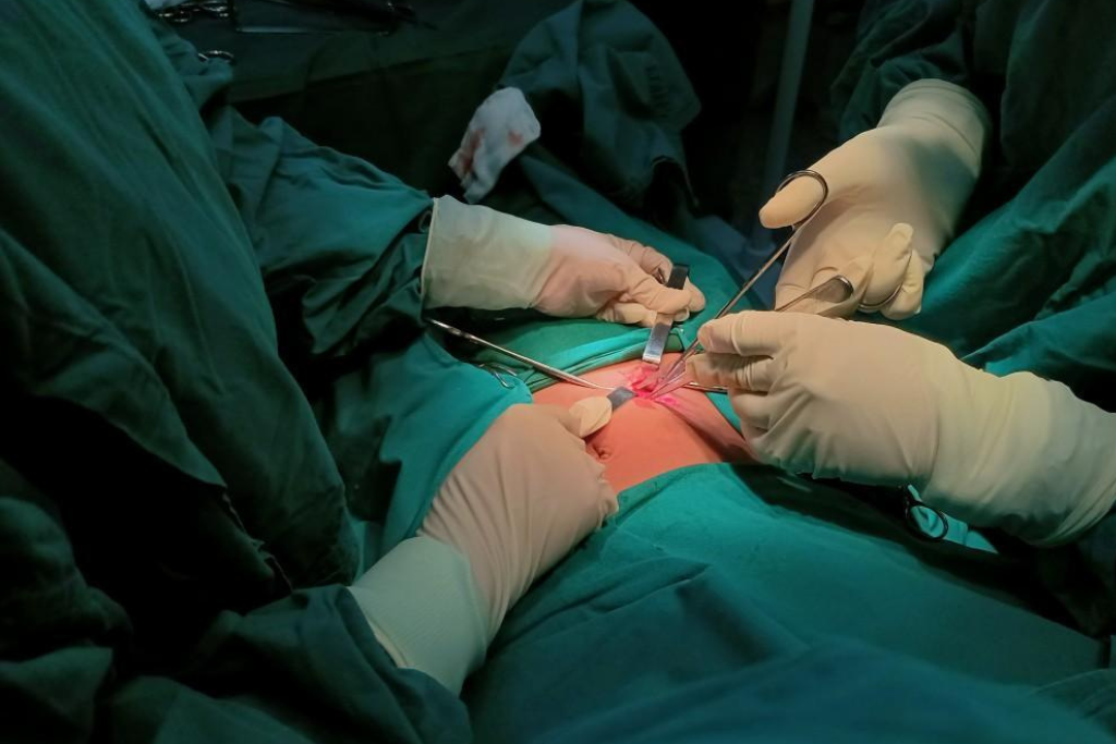 Gallstones: Causes, Symptoms, and When Surgery Is Needed
